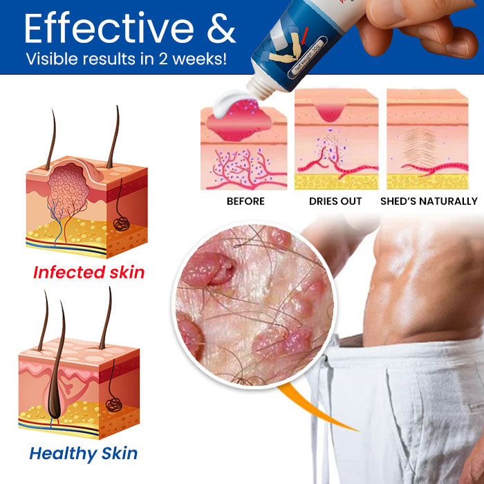 GentX Relief Cream ✅Now up to 70% Off! 💨💙