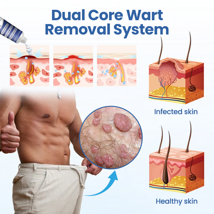 GentX WartRelief Cream