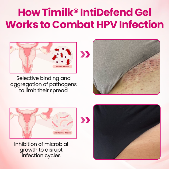 IntiDefend Anti-HPV Interferon Gel