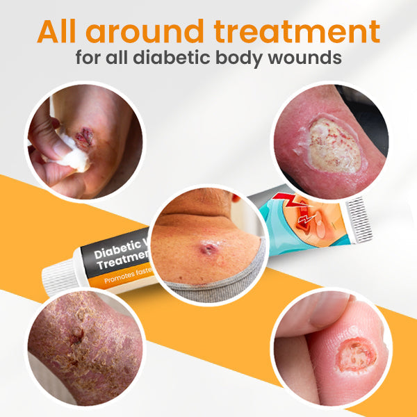 Diabetic Wounds Treatment Cream T