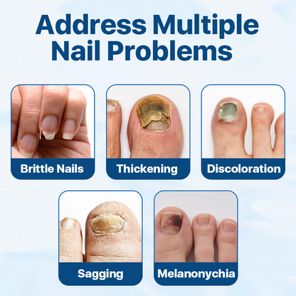 Candiclear Nail Fungus Treatment Cream