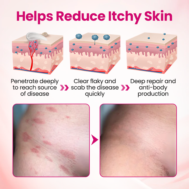 IntiDefend Anti-HPV Interferon Gel