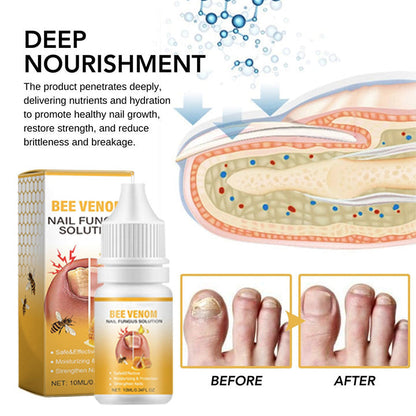 BeeVenom Nail Fungus Solution 🔥 Last Day Sale Off 70%🔥