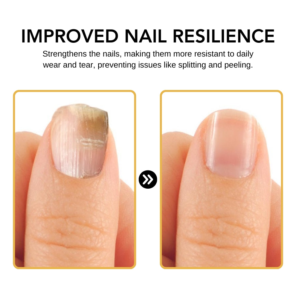 BeeVenom Nail Fungus Solution 🔥 Last Day Sale Off 70%🔥
