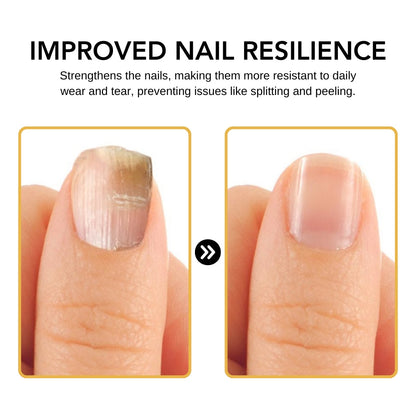 BeeVenom Nail Fungus Solution 🔥 Last Day Sale Off 70%🔥