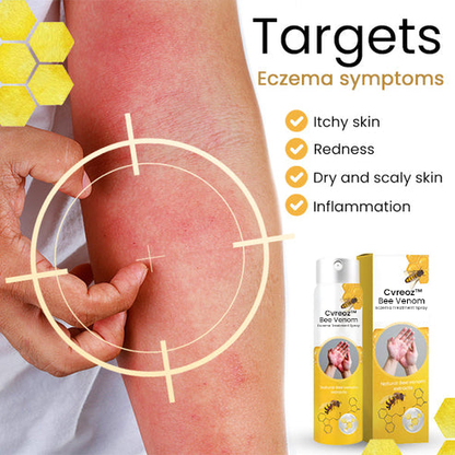 Bee Venom Eczema Treatment Spray – 💥 Last Day Sale Off 60% 🔥